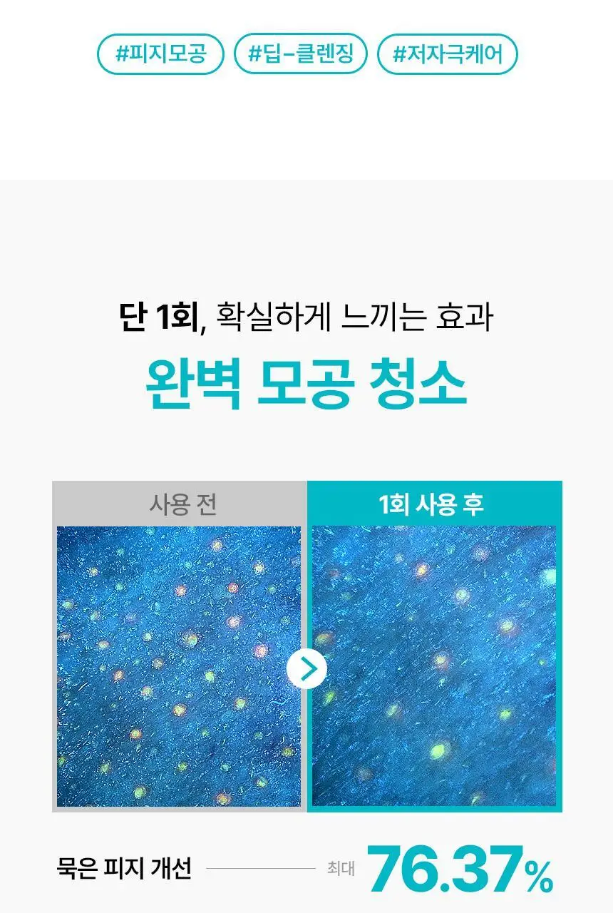 [800만개판매/1등피지클리너] 일소 슈퍼 멜팅 세범 소프트너 150g 기획 (+착붙솜 40매+모공텐션마스크팩1매) 상세페이지 9